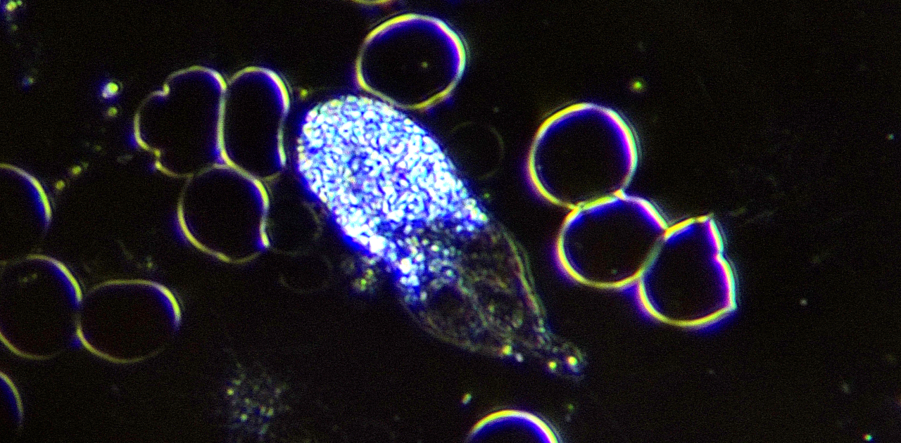 image of a White Blood Cell in motion, Laurier Herbalist